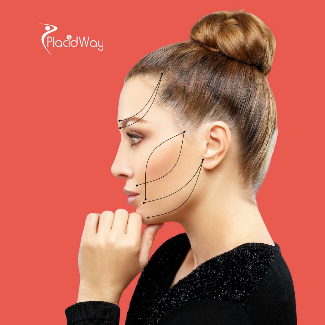 Rejuvenecimiento facial en Estambul, Turquía