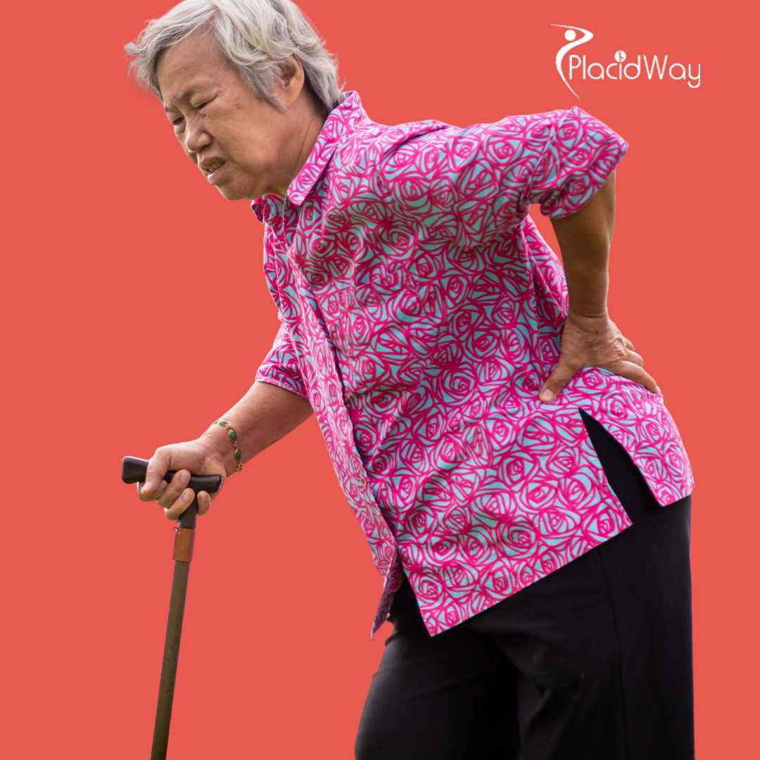 Cirugía de reemplazo de cadera en Estambul, Turquía