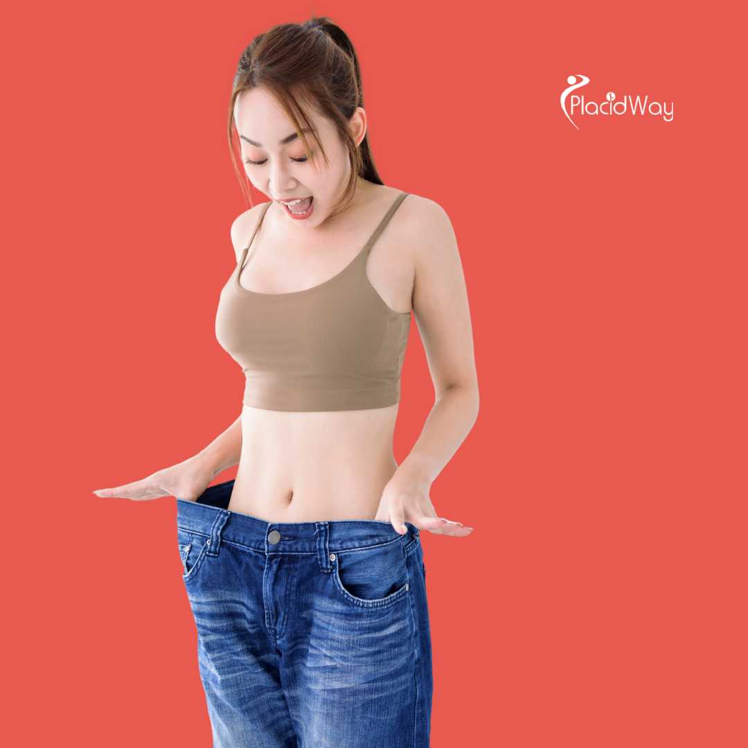 Cirugía Bariátrica en Mérida, México