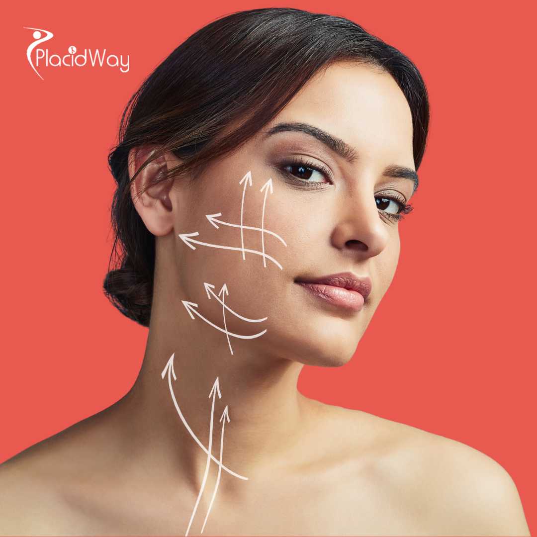 Lifting facial en Bogotá, Colombia