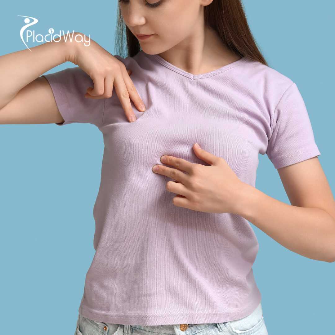 Aumento de Senos en la Ciudad de México, México