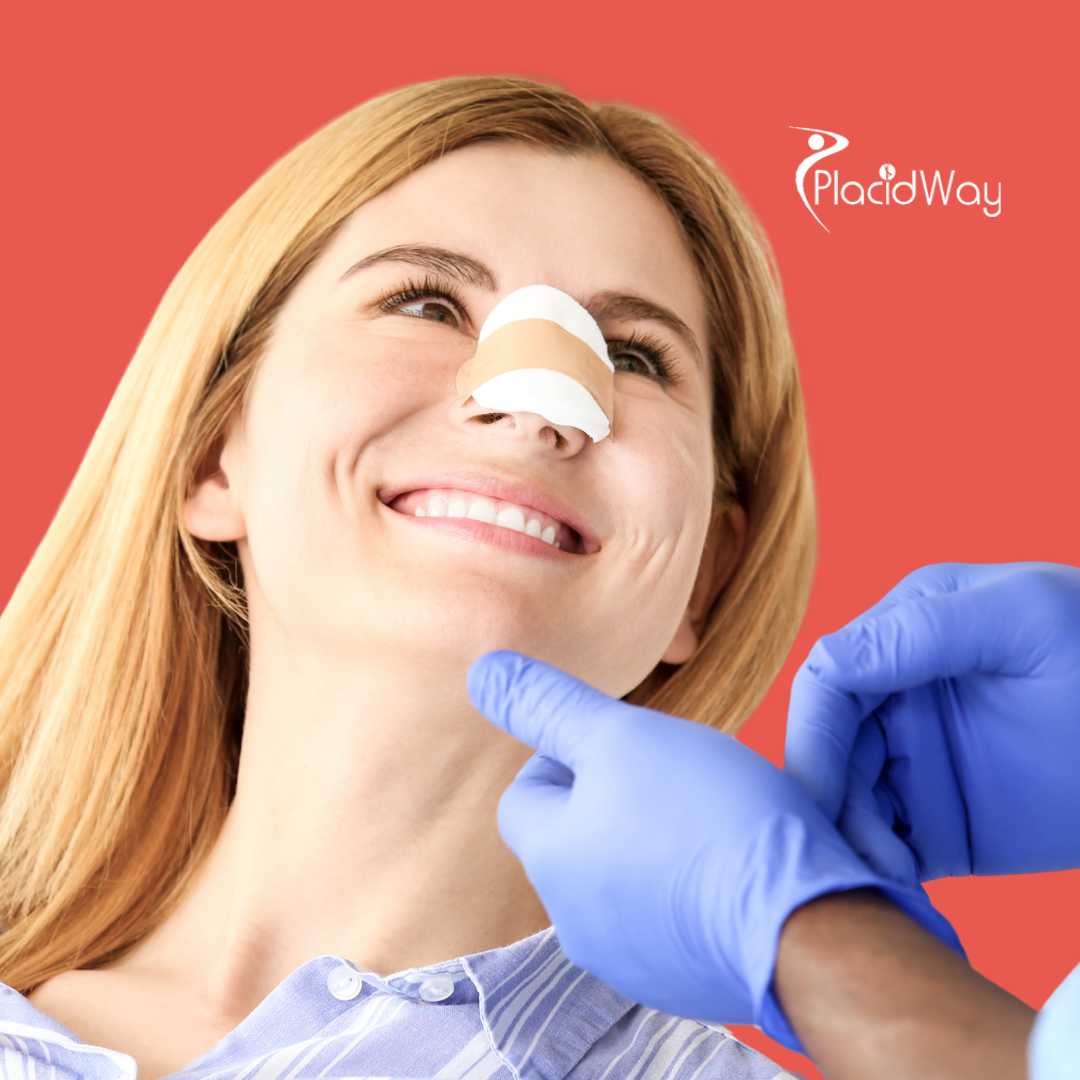 Rinoplastia en Mérida, México