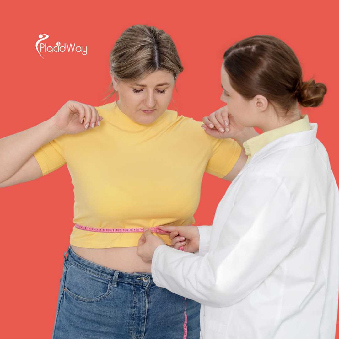 Cirugía Bariátrica en Mexicali México