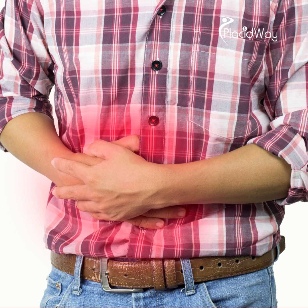 Cirugía de Manga Gástrica en Reynosa, México