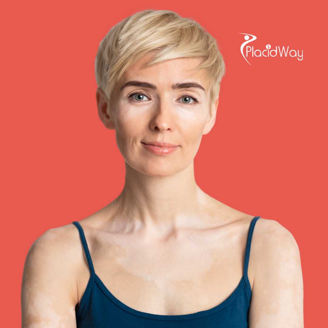 Terapia con células madre para enfermedades autoinmunes en Colombia