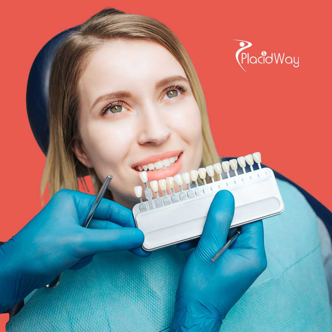 Carillas dentales en Zagreb, Croacia