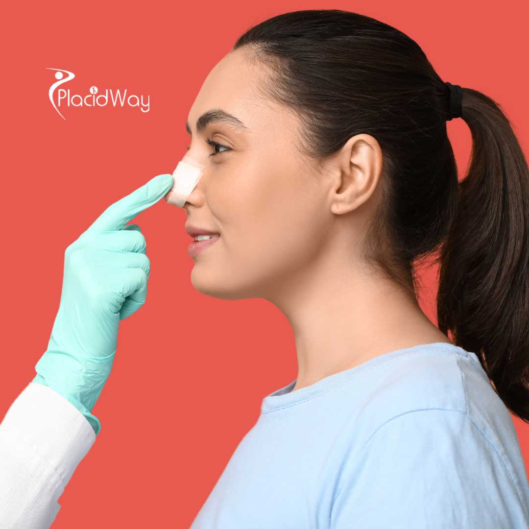 Cirugía de nariz en Colombia