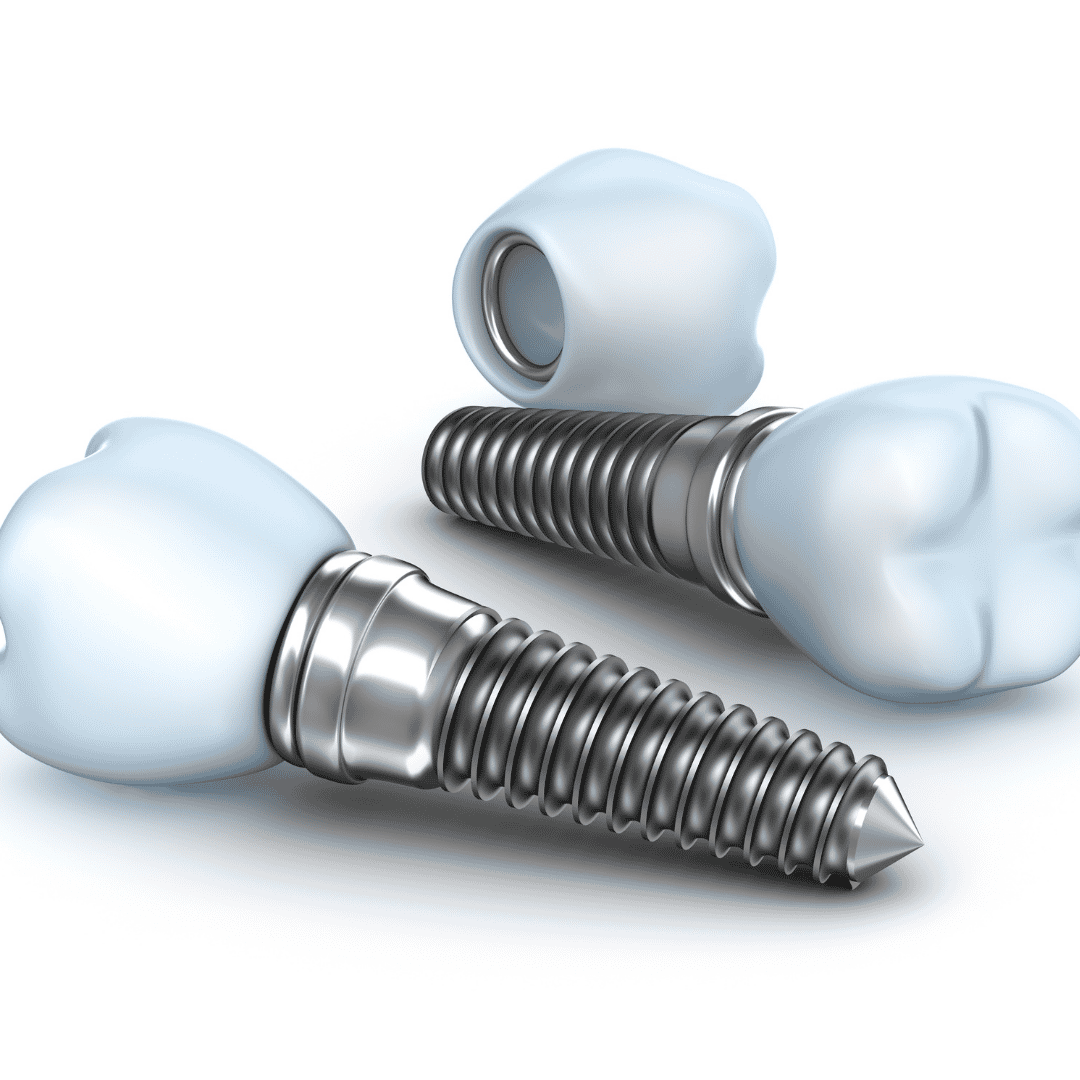 Affordable Package for Dental Implants in Antalya, Turkey