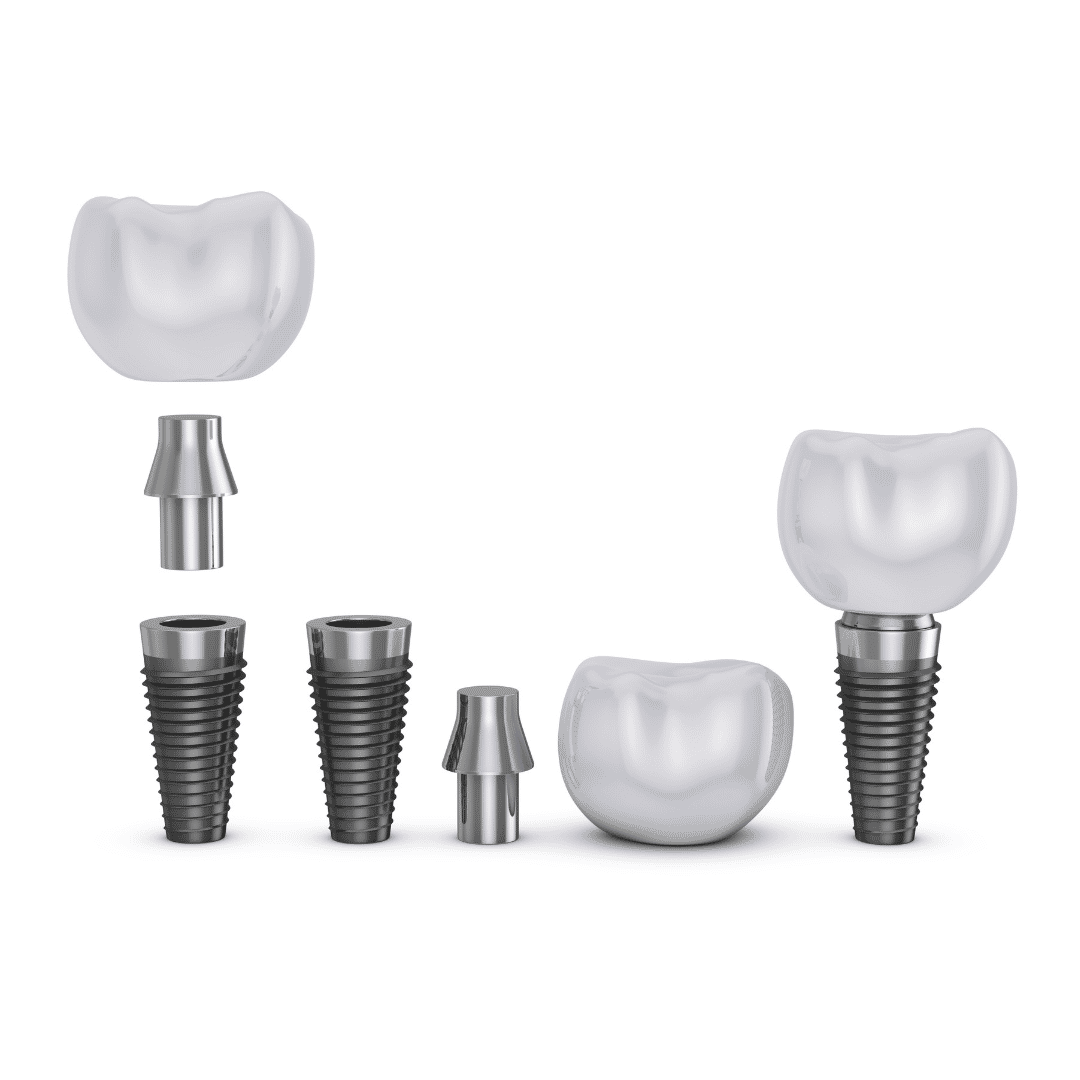 El mejor paquete de implantes dentales en Tijuana, México