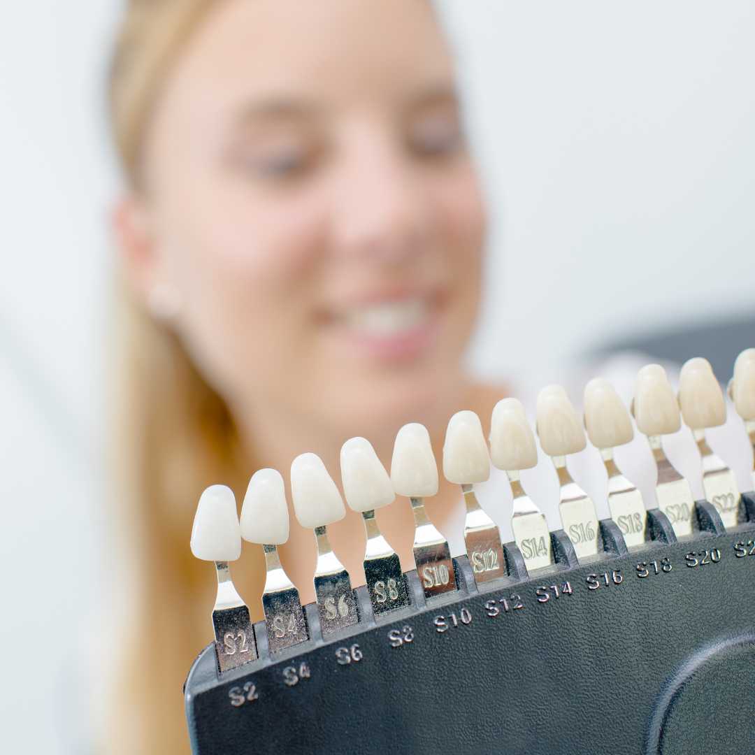 Dental Veneers Best And Affordable Package in Puerto Vallarta, Mexico