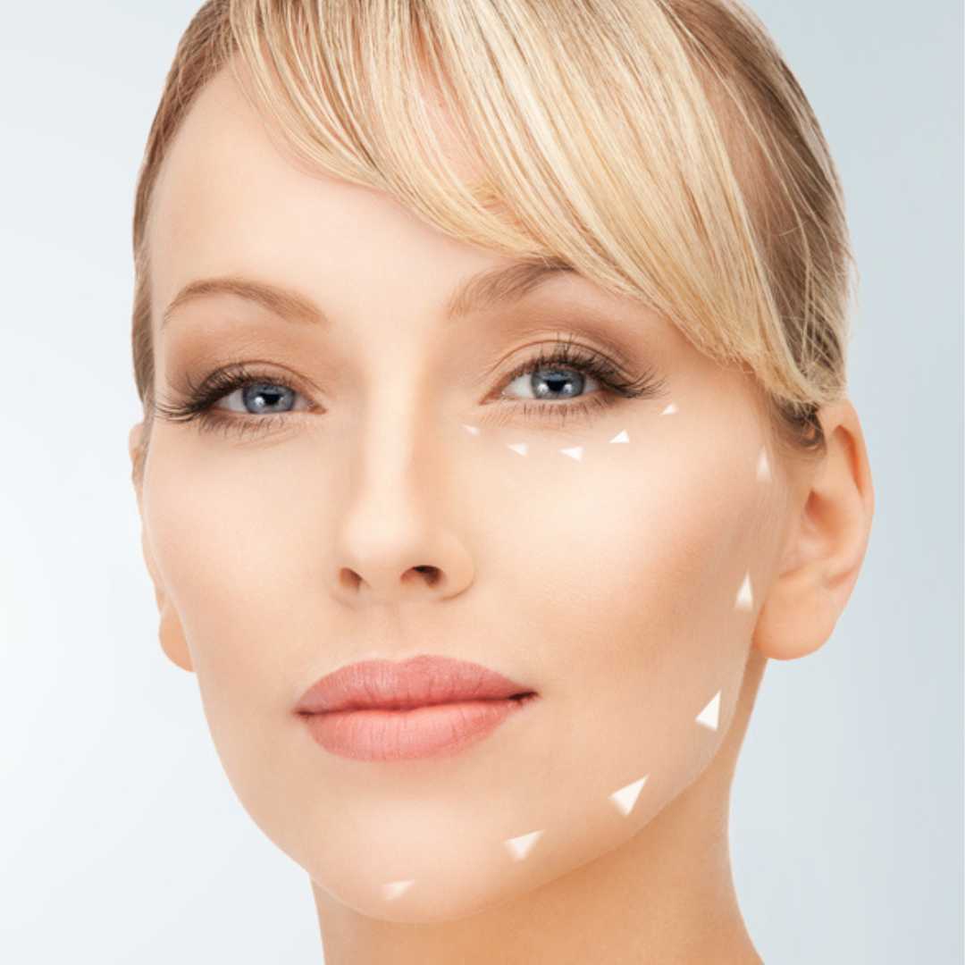 Paquete de lifting facial en Tijuana, México por Guerrero Plastic Surgery