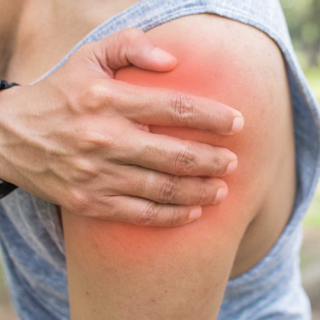 Paquete de terapia con células madre para lesiones del manguito rotador en Monterrey, México, de Stem Solutions