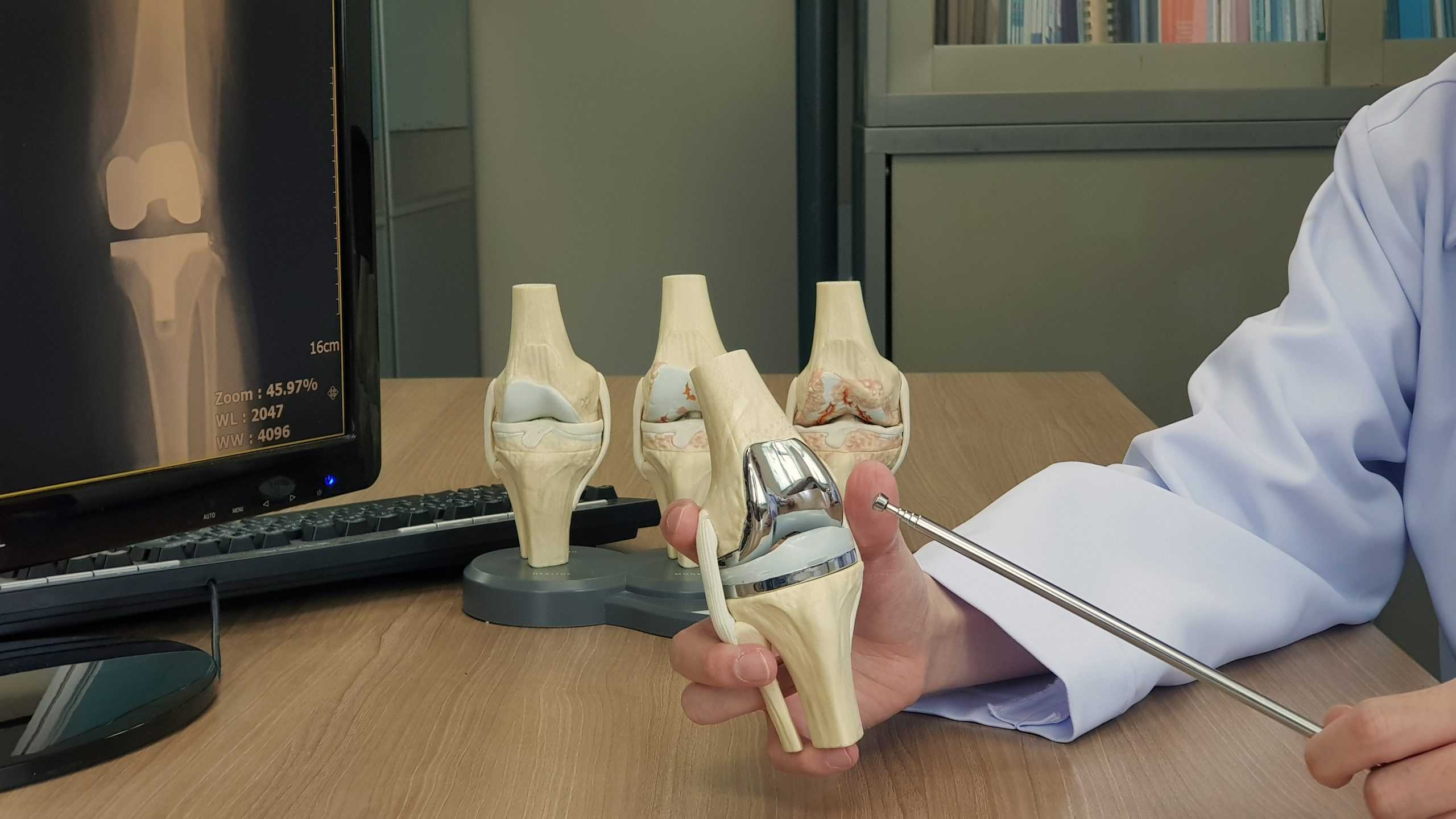  Paquete de tratamiento de reemplazo total de rodilla (TKR)