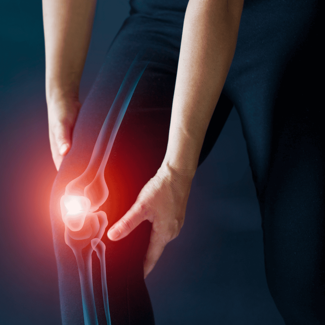 Células Madre República Dominicana: Tratamiento de la Osteoartritis por el Dr. Vargas Decamps en Santo Domingo