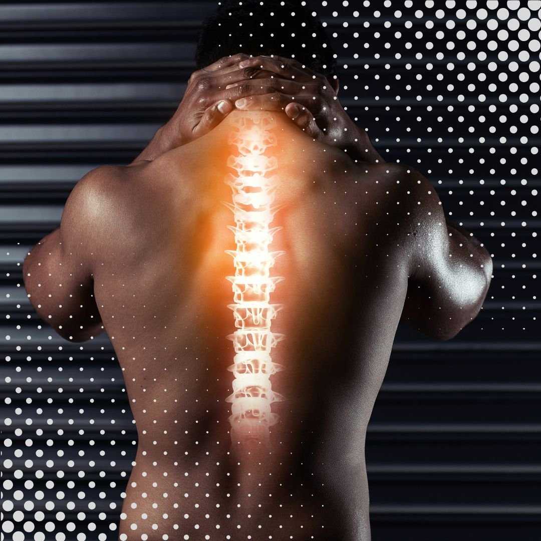 Paquete de Terapia con Células Madre para Hernias Discales en Santo Domingo, República Dominicana, por el Dr. Vargas Decamps