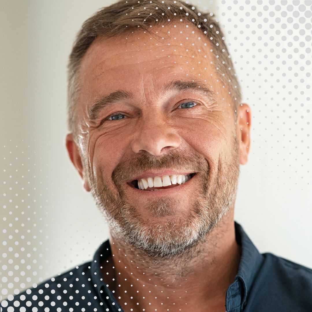 Paquete de implantes dentales All-on-4 en Los Algodones, México, de Best Dental Care