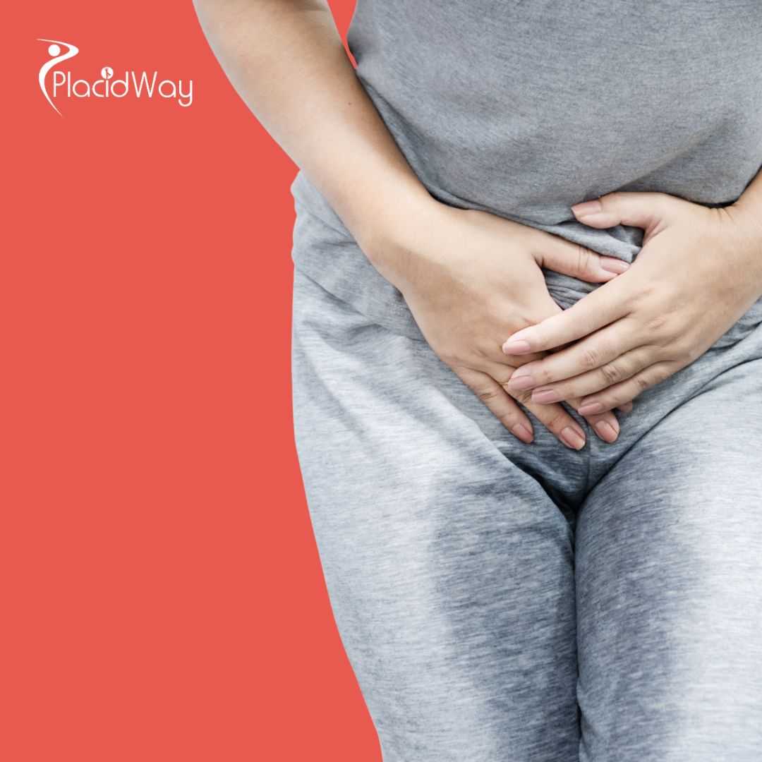 Paquete de tratamiento alternativo para el cáncer de vejiga en Tijuana, México, ofrecido por ITC.