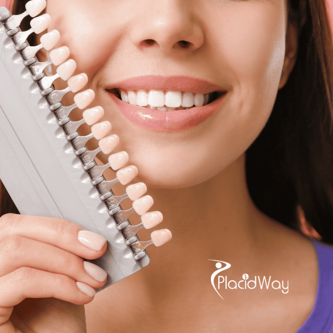 ¿Cómo pueden los médicos especialistas en carillas dentales de Turquía brindarle una sonrisa perfecta con tratamientos de alta calidad?