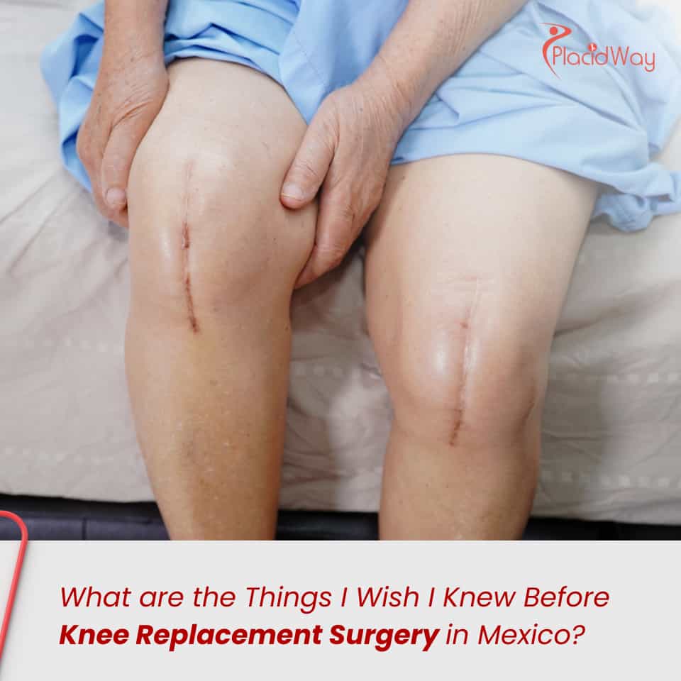 ¿Qué cosas me hubiera gustado saber antes de la cirugía de reemplazo de rodilla en México?