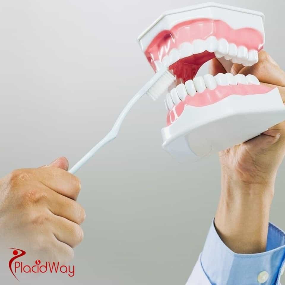 ¿Qué suelen incluir los paquetes de implantes dentales de boca completa en Turquía?