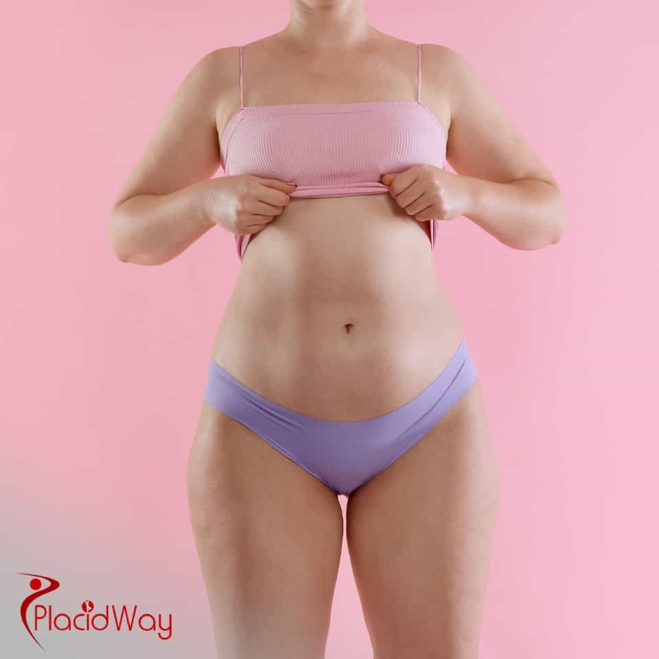 ¿Qué clínicas ofrecen liposucción en Colombia?