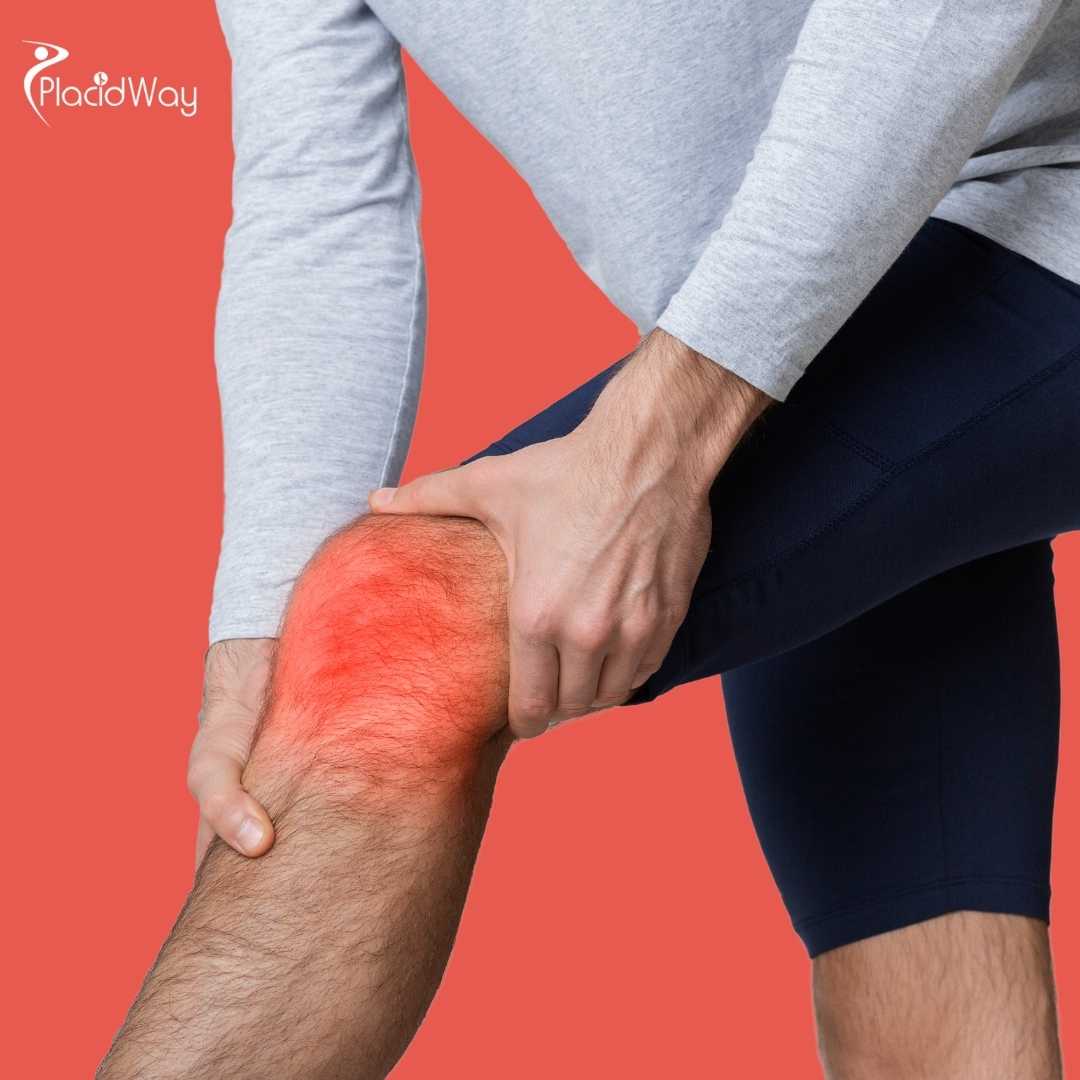 ¿Es la terapia con células madre para las rodillas en México mejor que el reemplazo de rodilla?