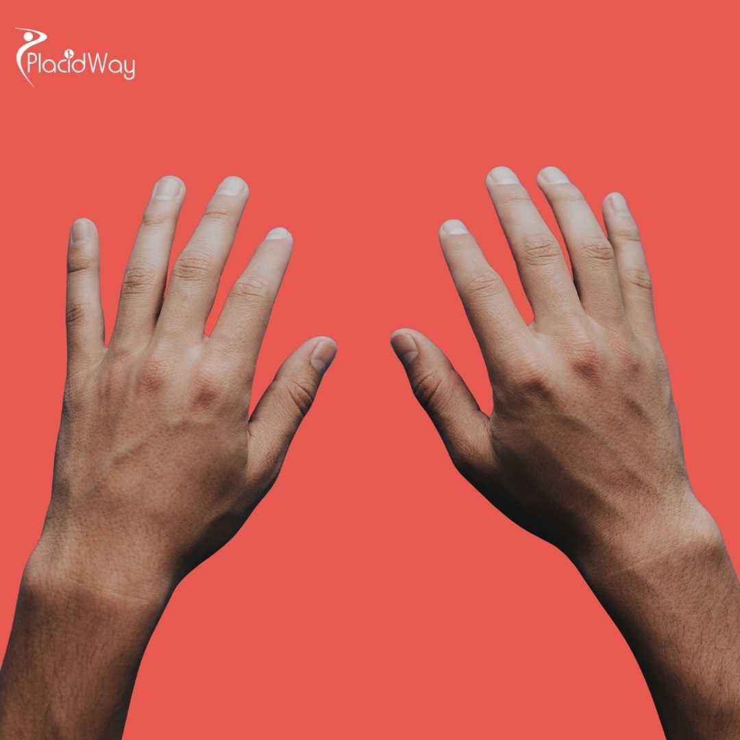 ¿Dónde puedo encontrar especialistas en cirugía de mano en Tijuana?