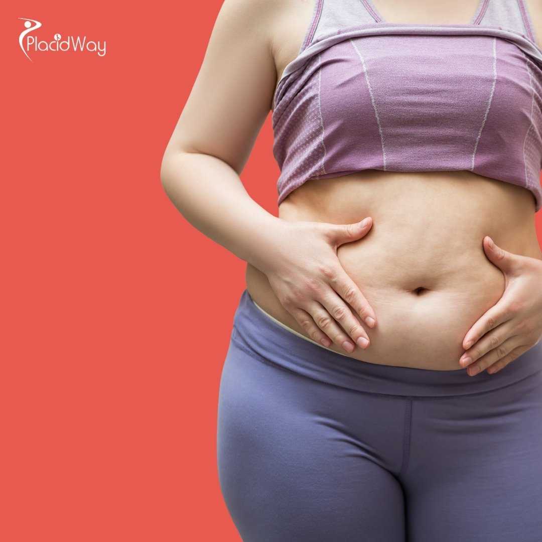 ¿Cuánto tiempo necesito estar en Tailandia para un Mommy Makeover?