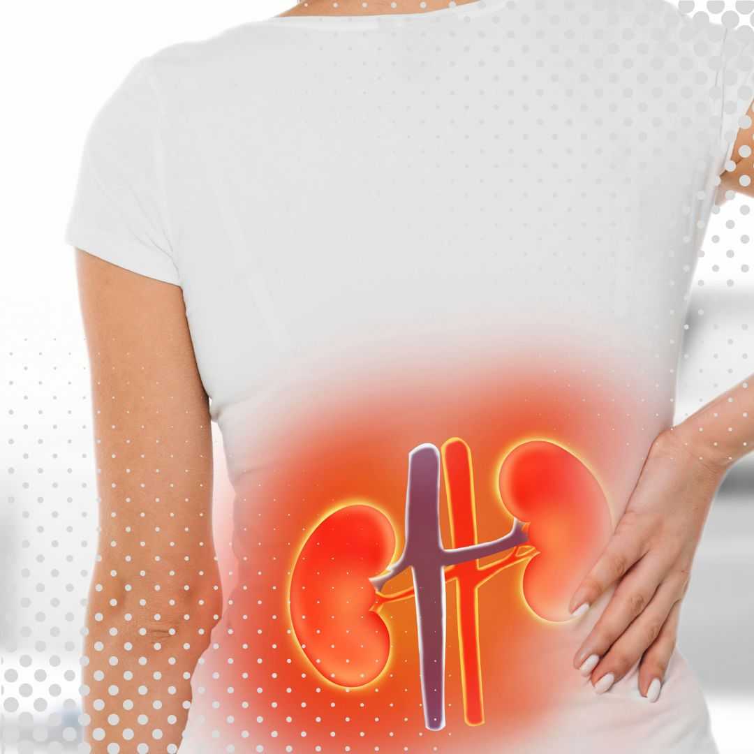 Cómo la terapia con células madre para la insuficiencia renal en MexStemCells en la Ciudad de México transformó la vida de Verónica