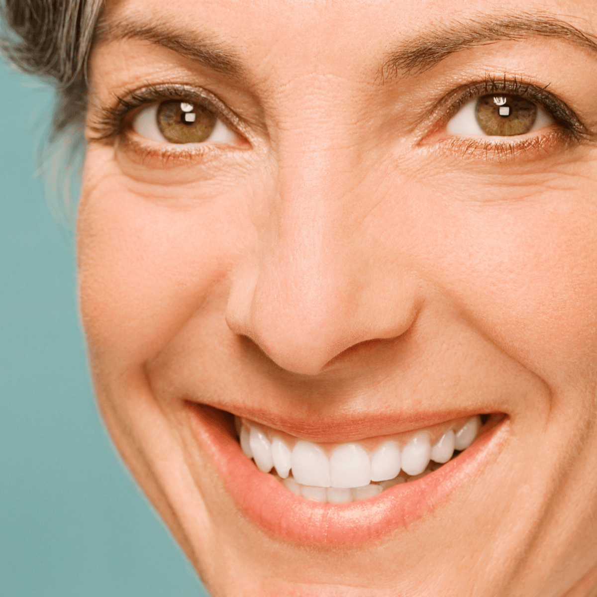 Implantes dentales en México: costo y clínicas 2025