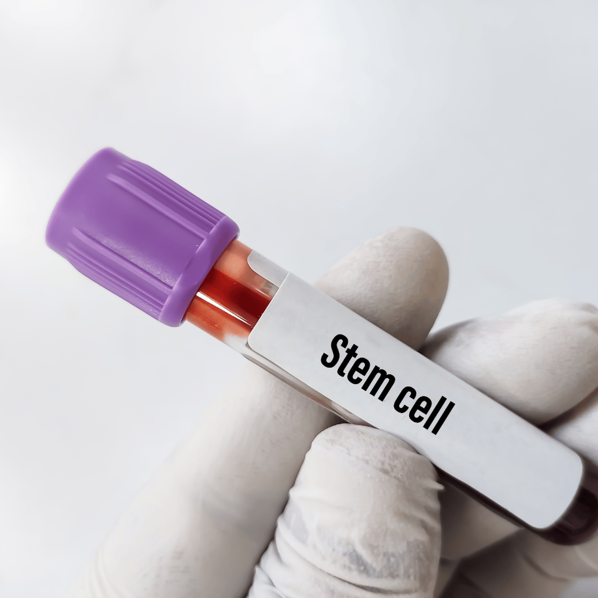 Tratamientos revolucionarios con células madre para afecciones neurológicas en la Ciudad de México: El éxito de la Clínica MexStemCells