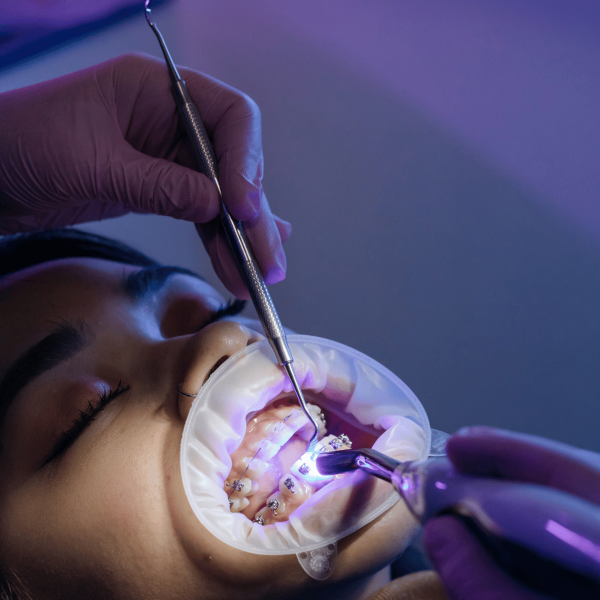 Los beneficios del turismo dental en Los Algodones: cómo RUMO Dental Group está redefiniendo la atención dental
