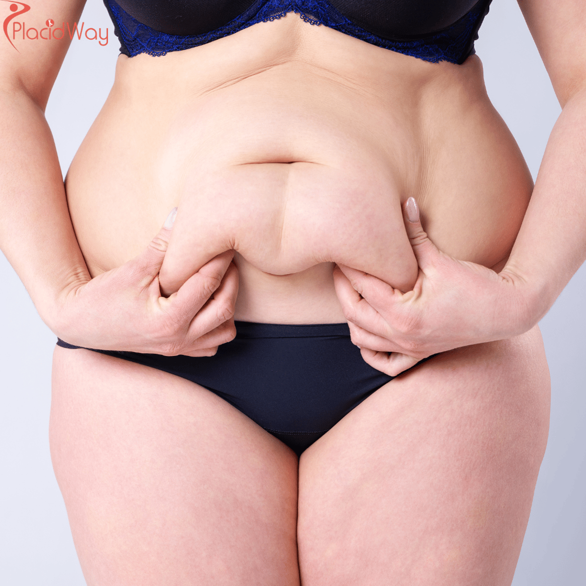 Abdominoplastia y levantamiento de senos: el cambio de imagen perfecto para mamás en Colombia