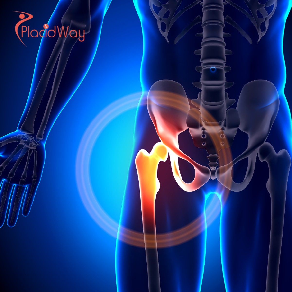 Recuperación más rápida y alivio del dolor: terapia con células madre para problemas de rodilla y cadera en México