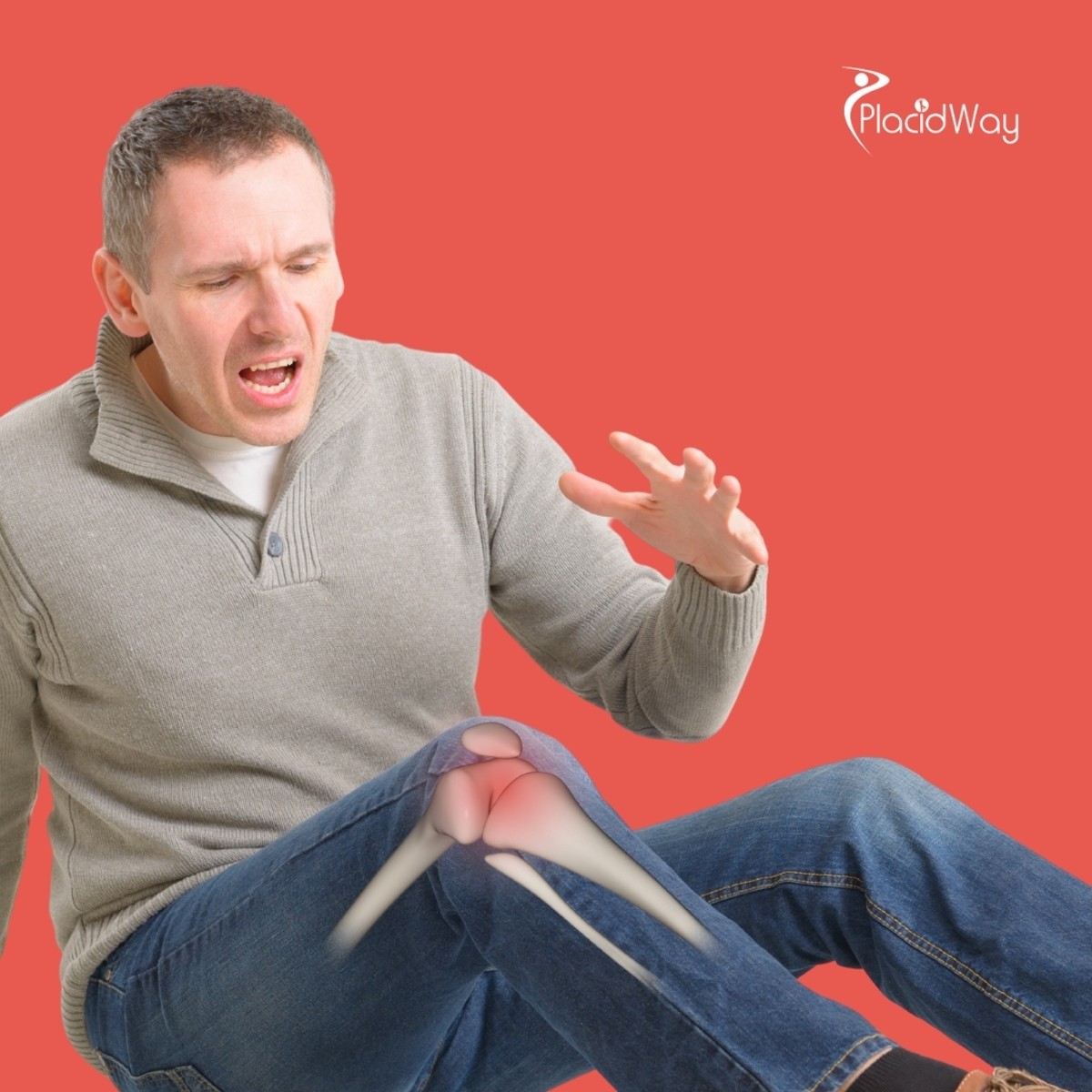 Terapia con células madre para la osteoartritis de rodilla en México: Guía para pacientes brasileños