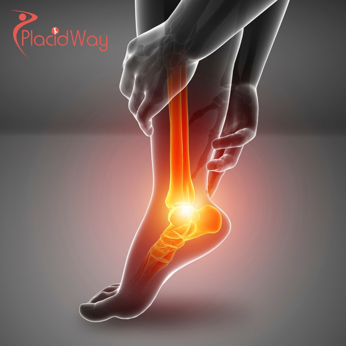 Terapia con células madre ortopédicas en Colombia: La guía definitiva para la salud regenerativa de las articulaciones