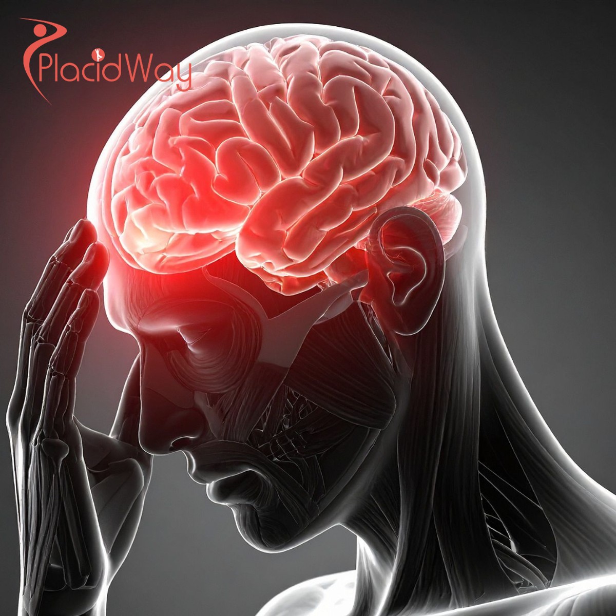 Tratamiento con células madre en neurología en Colombia: Guía experta para turistas médicos