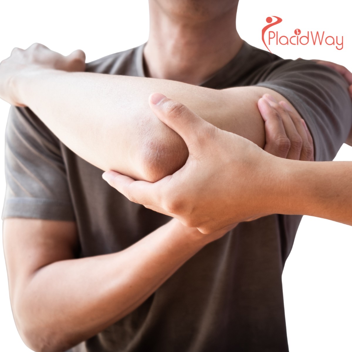 5 cosas que debes saber sobre la cirugía del manguito rotador en Estambul, Turquía.