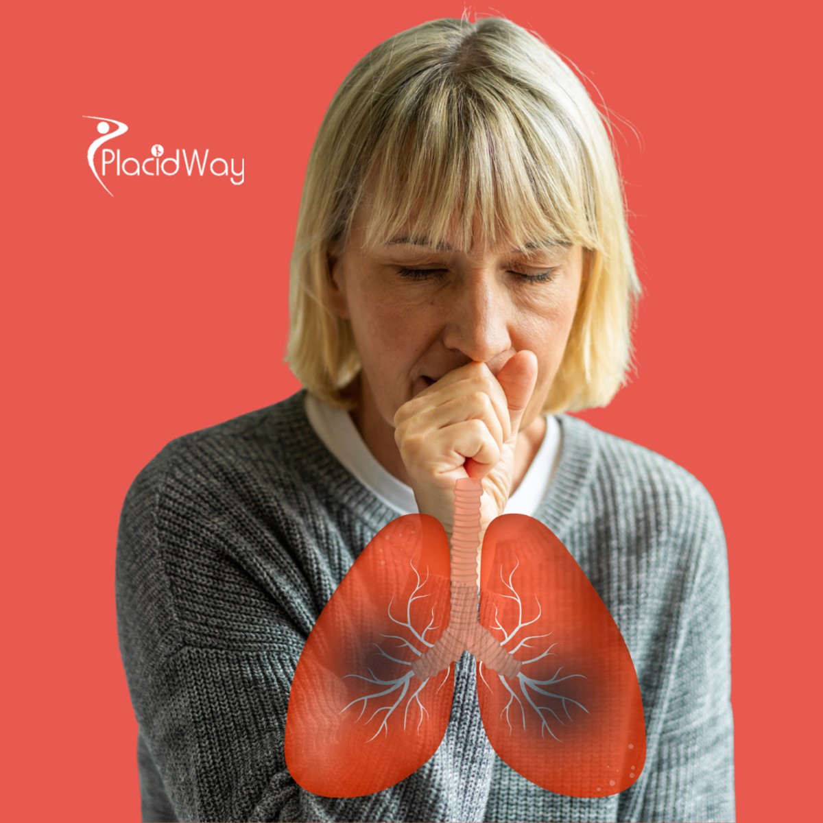 Tratamiento del cáncer de pulmón en México: Terapias inmunológicas y alternativas 