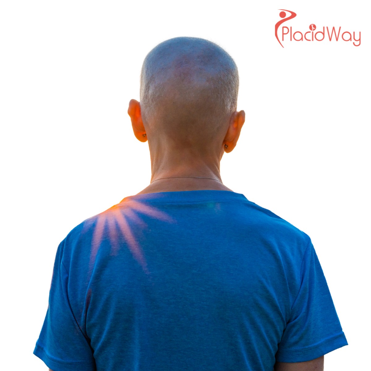 Alternativas no quirúrgicas para el tratamiento del cáncer colorrectal en Tijuana