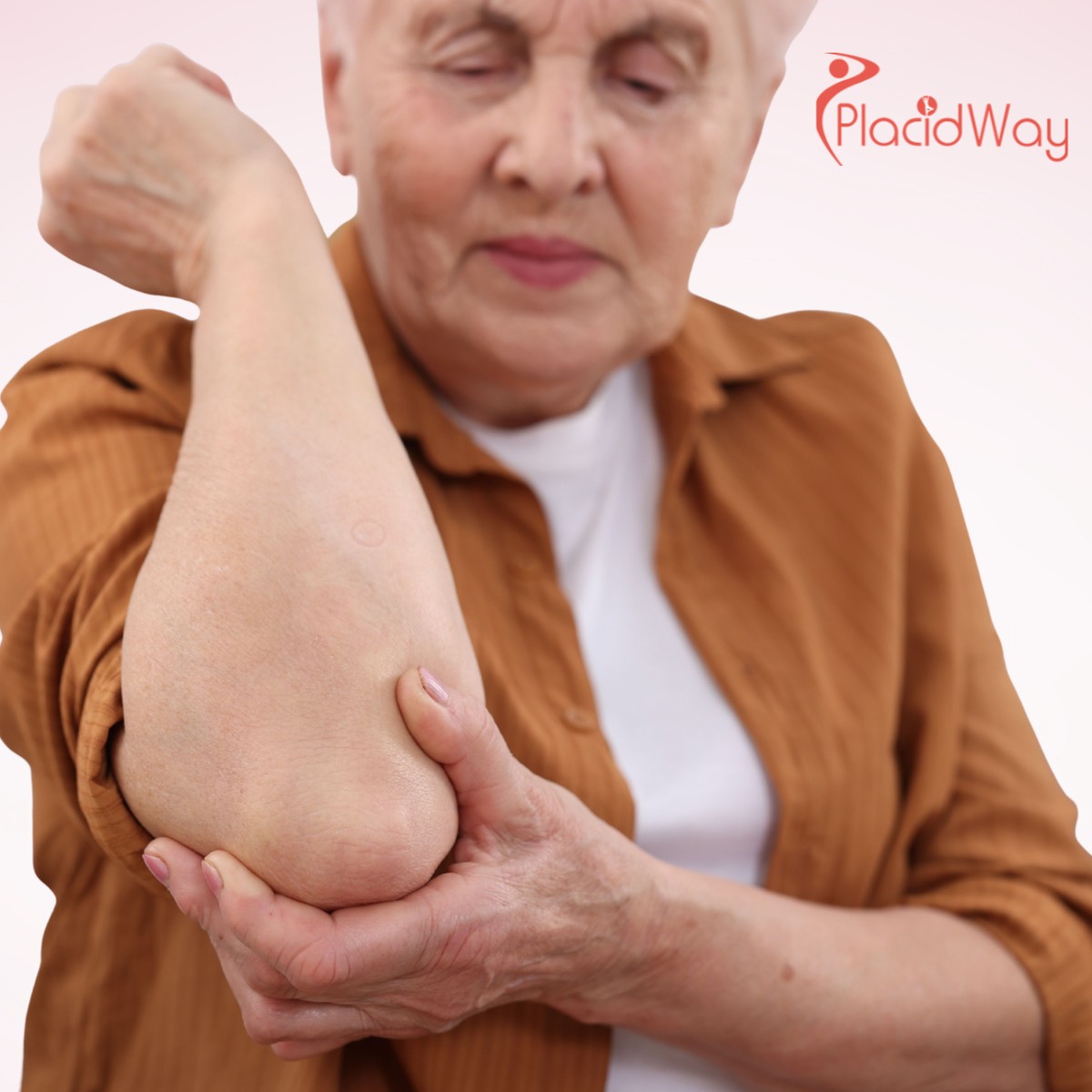 Tratamiento de la osteoartritis en México: Cómo las células madre ofrecen esperanza en Guadalajara