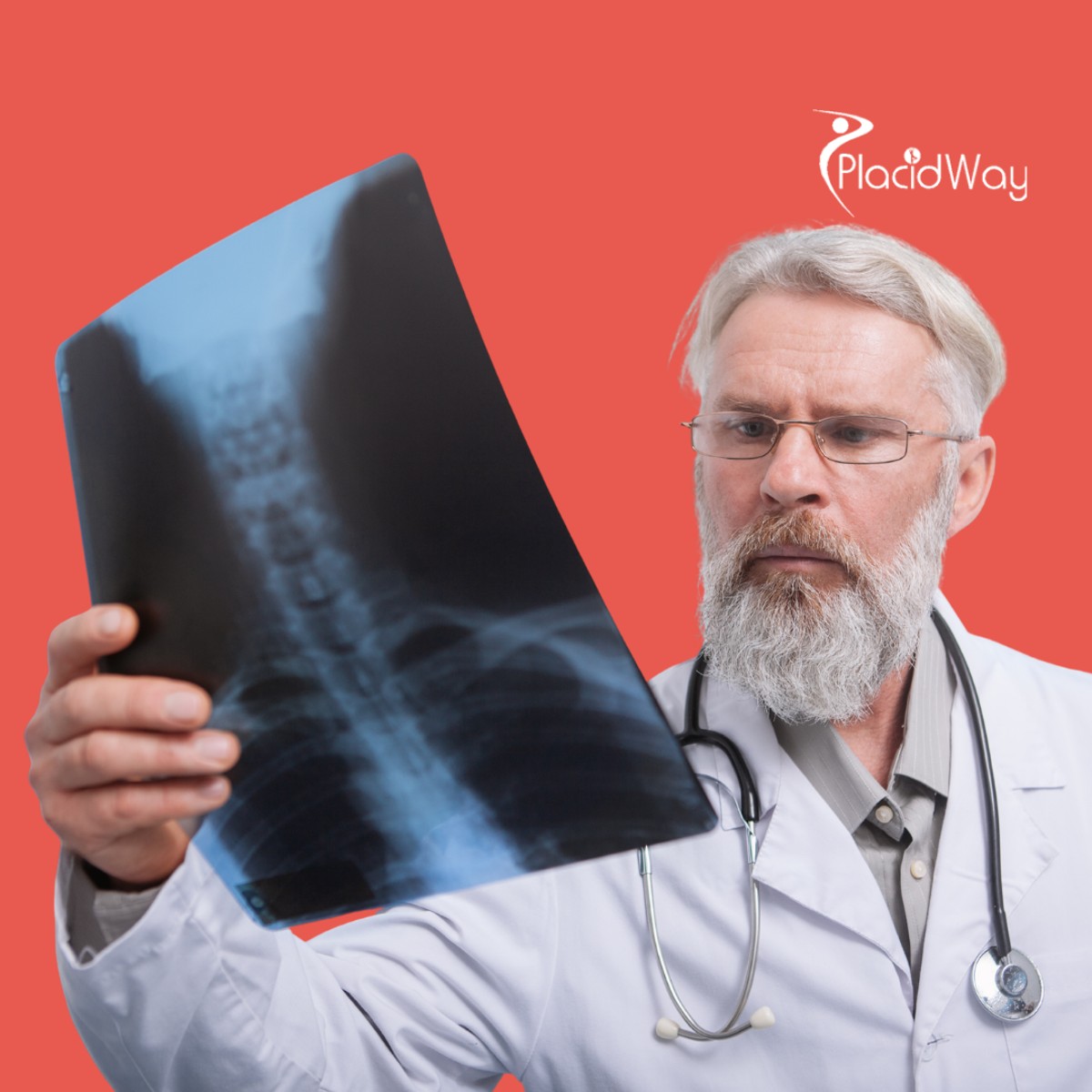 Información sobre el tratamiento del cáncer de hueso para pacientes que consideran México