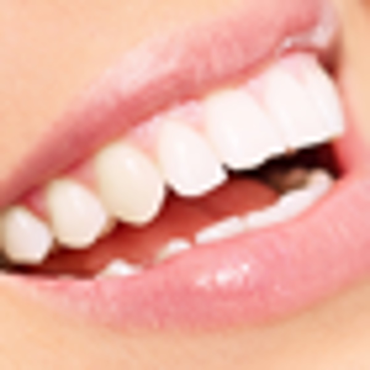 Implantes dentales en San José, Costa Rica - $700