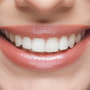 Paquete de implantes dentales All on 4 en Cancún, México con YeahSmile thumbnail