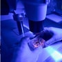 Paquete de infusión de células madre en Stem Cells Kyron Cali, Colombia thumbnail