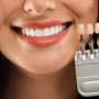 Cambio de imagen de sonrisa en Estambul - Sonrisa de Hollywood, implantes, coronas en Estambul thumbnail
