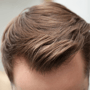 Trasplante de cabello FUE en Bellus Clinic: recupera tu cabello con Bellus Clinic thumbnail