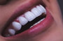 Paquete de cambio de sonrisa en Sonrisa Italiana - Clínica Dental Colombia, Barranquilla, Colombia thumbnail