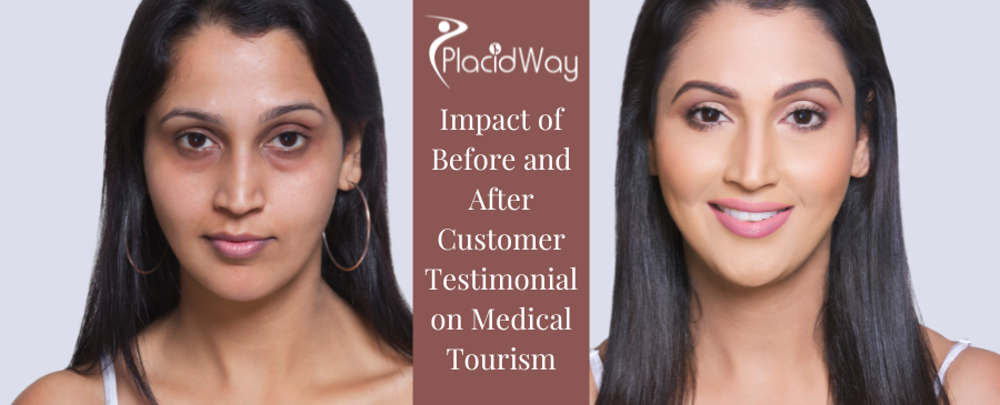 Maximize Your Success with Before and After Testimonials - Partner with PlacidWay Today 