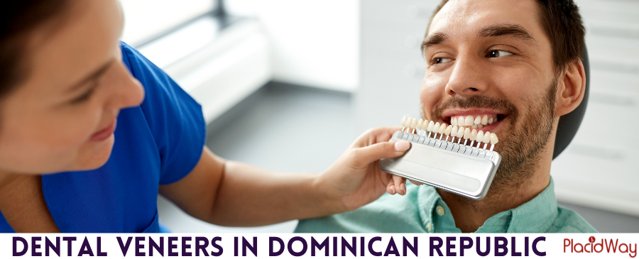 Carillas dentales en República Dominicana: económicas y seguras